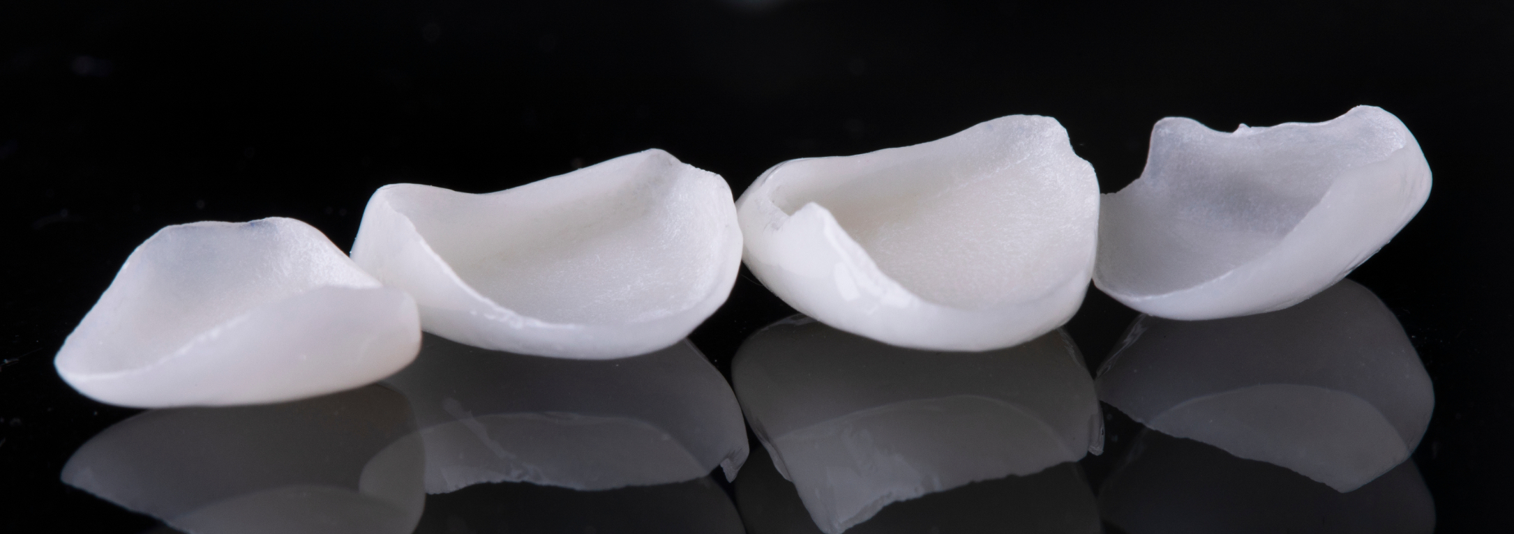 Veneers Without Shaving Teeth